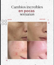 Medicube PDRN Pink Peptide Serum de 30 ml - Imagen 3